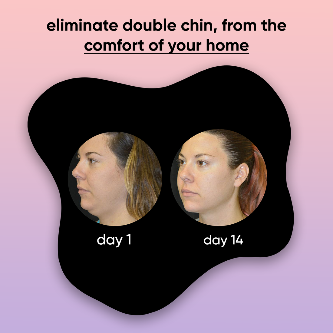 Fivamo - 4-in-1 facial sculptor